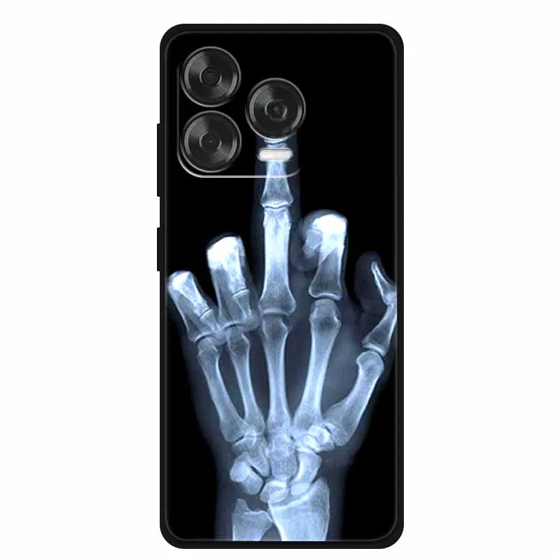 Animal Design Soft Silicone TPU Phone Case - Durable Back Shell and Bumper Cover