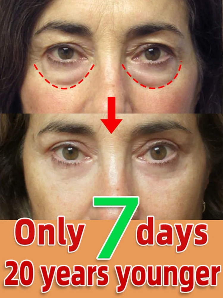 

Eye Bag Cream 7 Days Anti Wrinkle Remove Puffiness Dark Circles Puffiness Firming Smooth Skin Care Moisturising