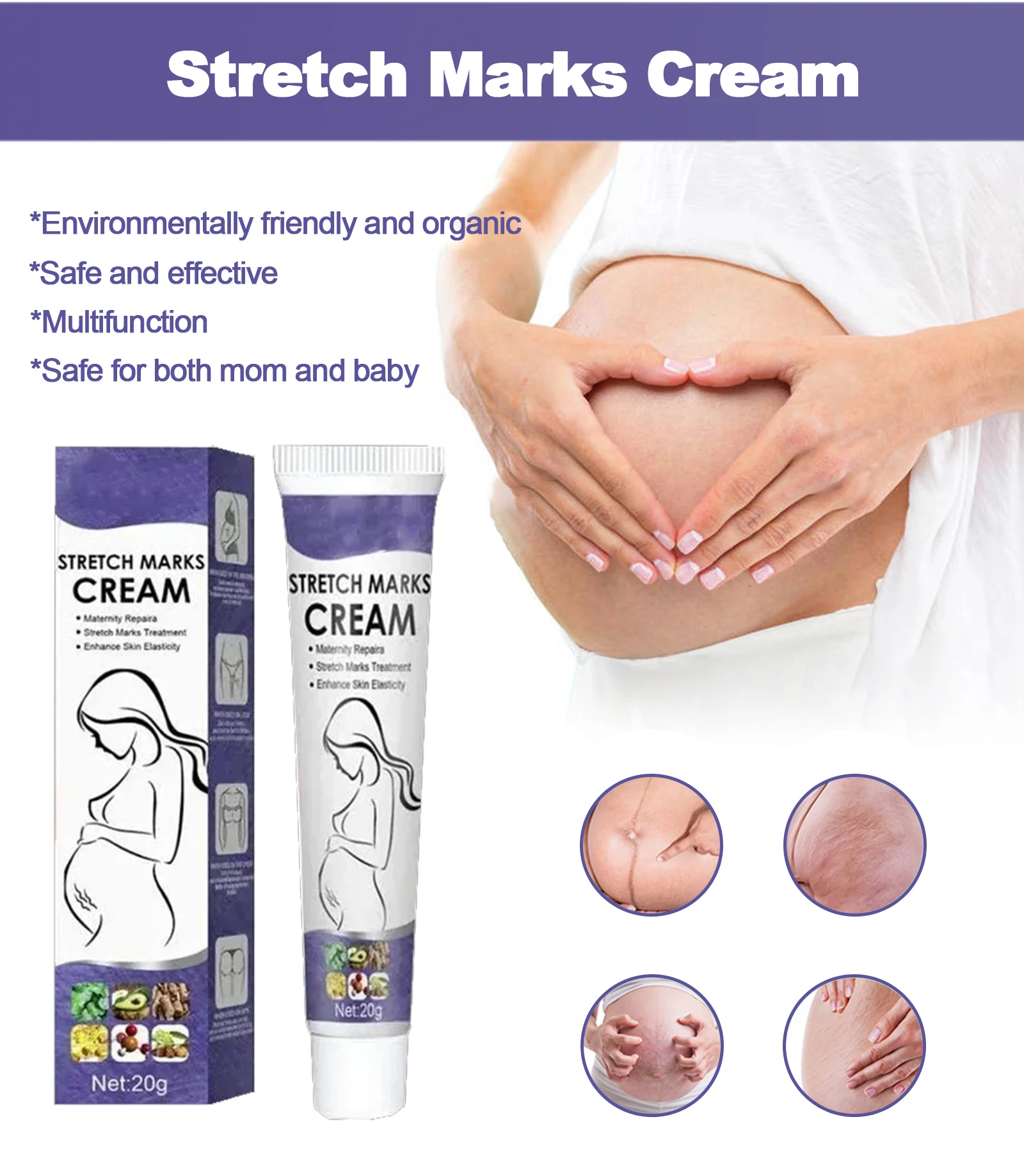 Stretch mark removal cream, Postpartum repair of fat marks on thighs, Stretch mark removal cream