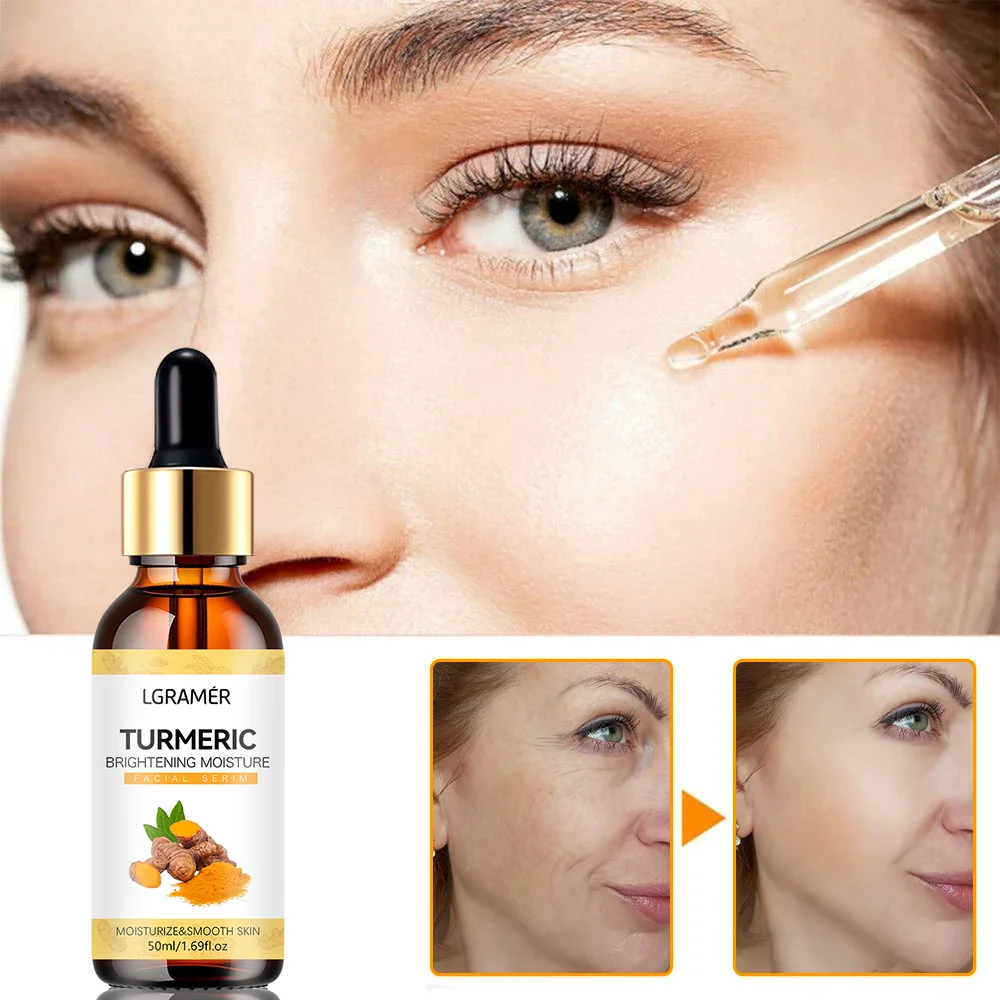 Turmeric Freckle Whitening Serum Anti-oxidant Nourishing Moisturizing Repair Skin Brighten Fade Dark Spot Essence Face Care 2