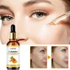 Turmeric Freckle Whitening Serum Anti-oxidant Nourishing Moisturizing Repair Skin Brighten Fade Dark Spot Essence Face Care 2