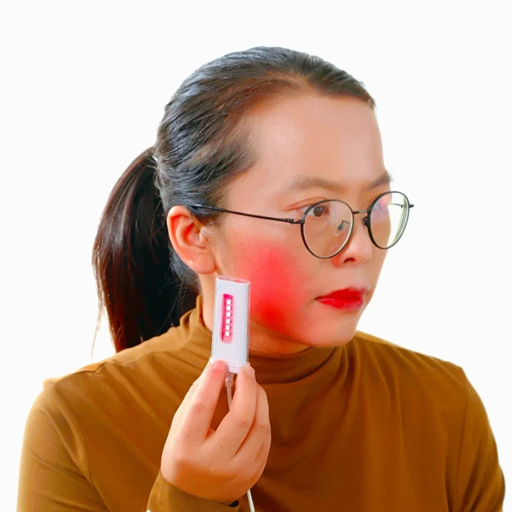 Treatment of Mouth Ulcers Laser Pharyngitis Bad Breath Sore Throat Mouth Ulcers