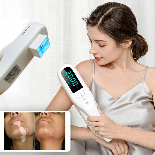 

Dermatology Portable Targeted Excimer Light Laser 308nm Excimer Laser Lamp for Vitiligo Psoriasis Treatment Home Use