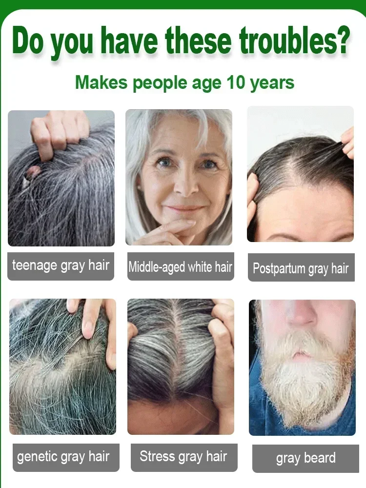 Natural Anti Gray Hair Serum-Repair White & Darkening Hair Nourishing Care Remedy anti gray hair serum