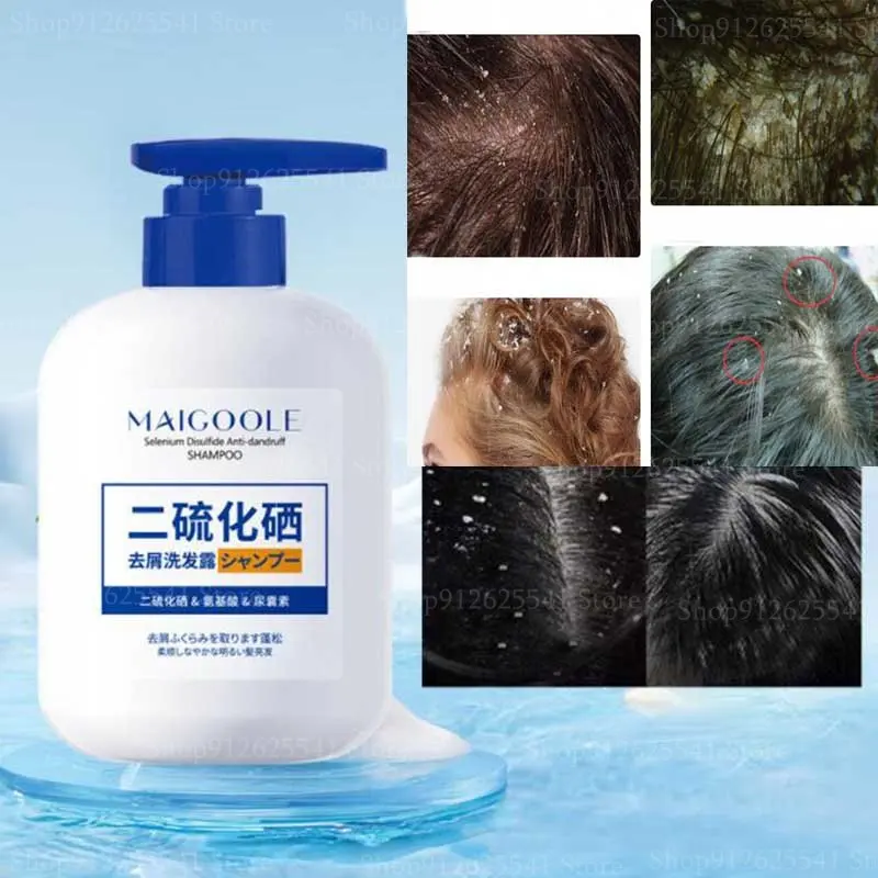 

300ml Anti-Dandruff Treatment Itching Flaking Scalp Psoriasis Shampoo Therapeutic Shampoo Seborrheic Dermatitis Oil Control