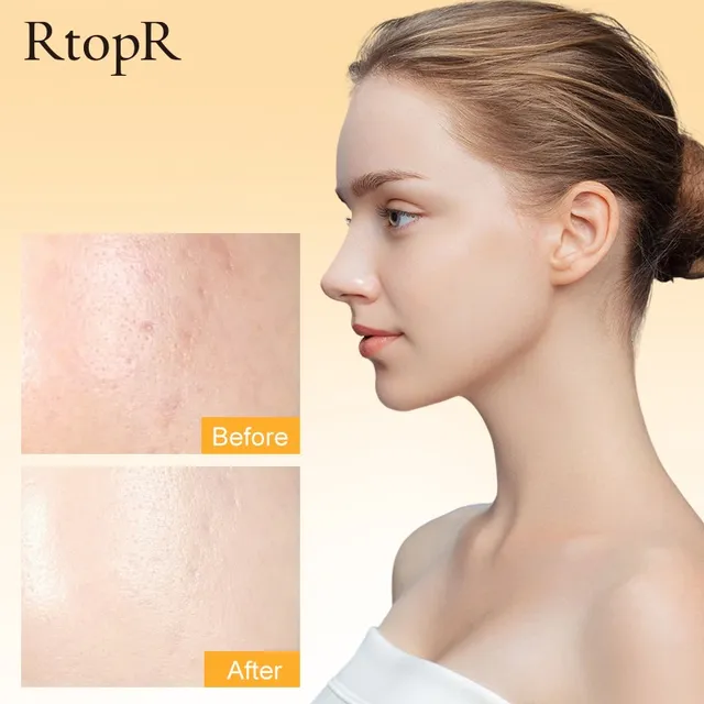 Rtopr C -Vitamin Arckrém Fehérítés Világosító Szelíd Tápláló Hidratáló Melanin Redukció Finom Vonalak Megújító Bőr - Image 3