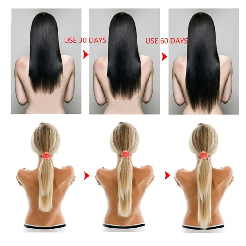 Rice Hair Growth Shampoo Anti Hair Loss Treatment Serum Fast Growth Longer thicker for Men Women