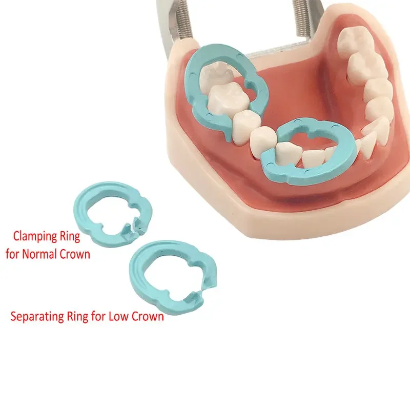 

4Pcs/Lot Dental Resin Rings Blue Clamping Separating Ring Autoclavable Dentist Tools