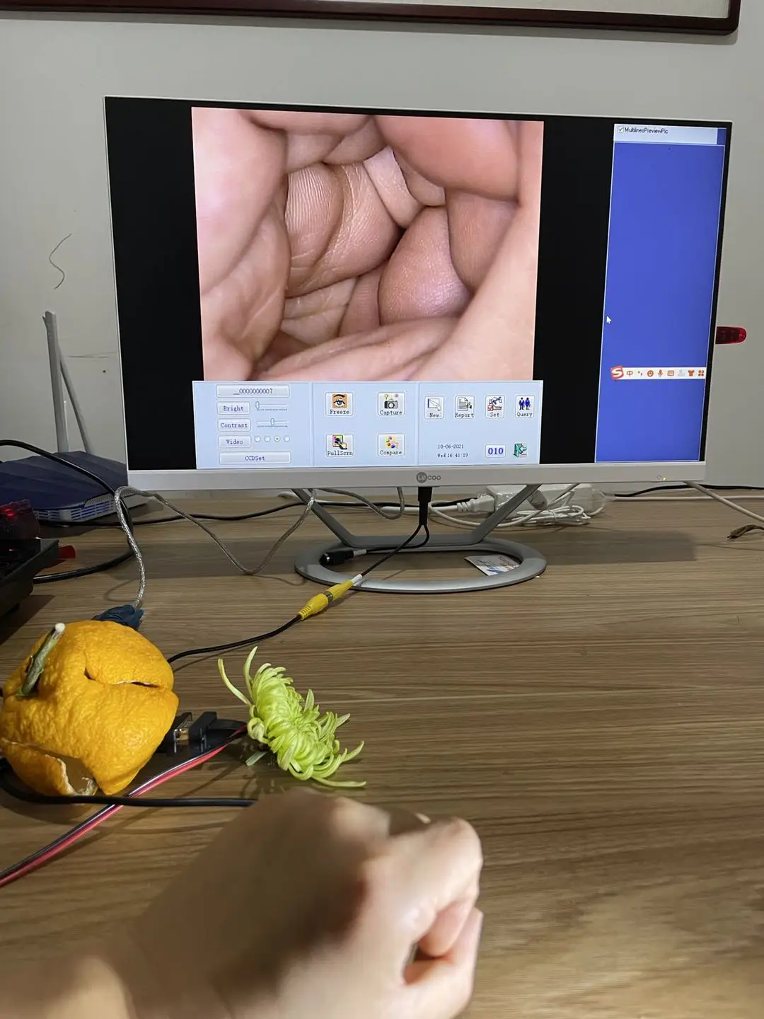 thumb