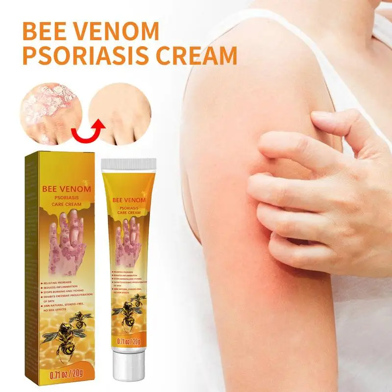 

Psoriasiss Cream Effective Anti-itch Relief Dermatitis Urticaria Unguent Bee Venoms Cream Skin Care 20g