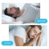 30 Days/Box Nasal Breathing Dilators Starter Kit Magnetic Nose Strips Increase Sports Air Intake Improve Sleeping Reduce Snoring 3