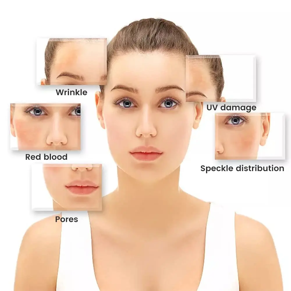 Analizzatore Cutaneo 1000X, Dermatoscopio Wireless, Analizzatore per Viso e Corpo, Microscopio Elettronico Professionale per Bellezza e Salute - immagine 2