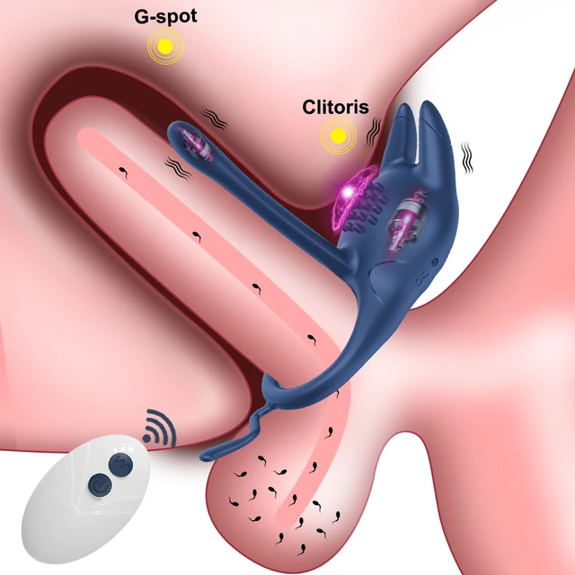 Fernbedienung Penis Ring Ejakulation Vibrator für Männer Cock Ring Verzögerung Klitoris Stimulation Penetration Sex Spielzeug für Paare 1