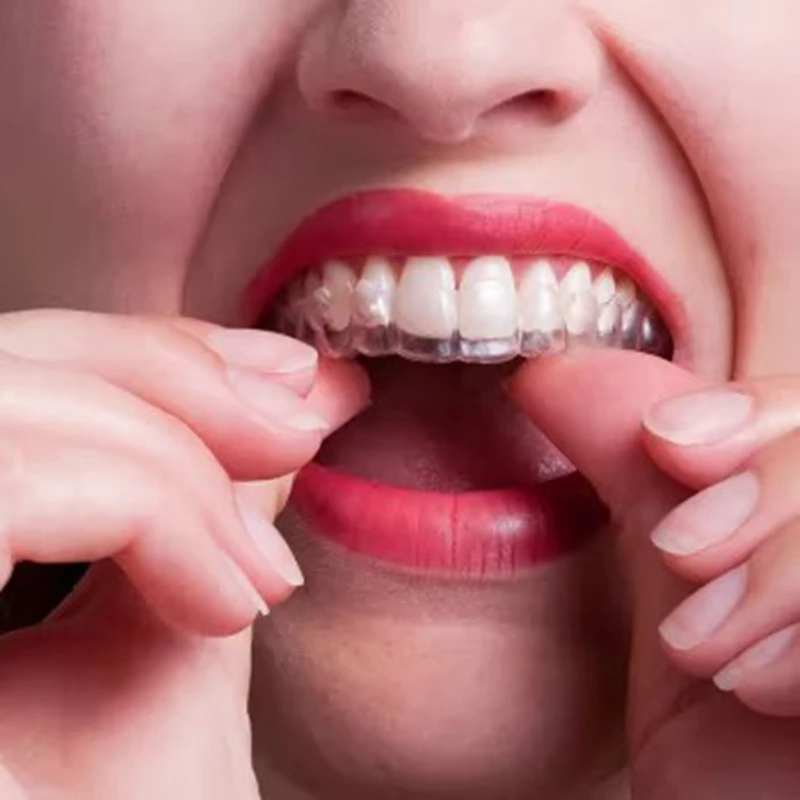 1/2 шт., ночная защита для зубов