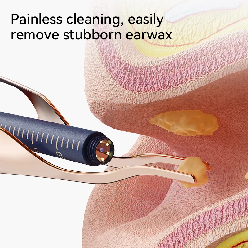upgraded smart visual ear wax cleaner with camera 800w hd endoscope multi functional visual ear cleaning tool includes storage Upgraded Smart Visual Ear Wax Cleaner With Camera 800W HD Endoscope Multi-Functional Visual Ear Cleaning Tool Includes Storage 5