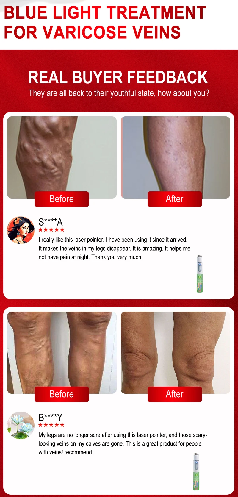 Laser Vein Medical level