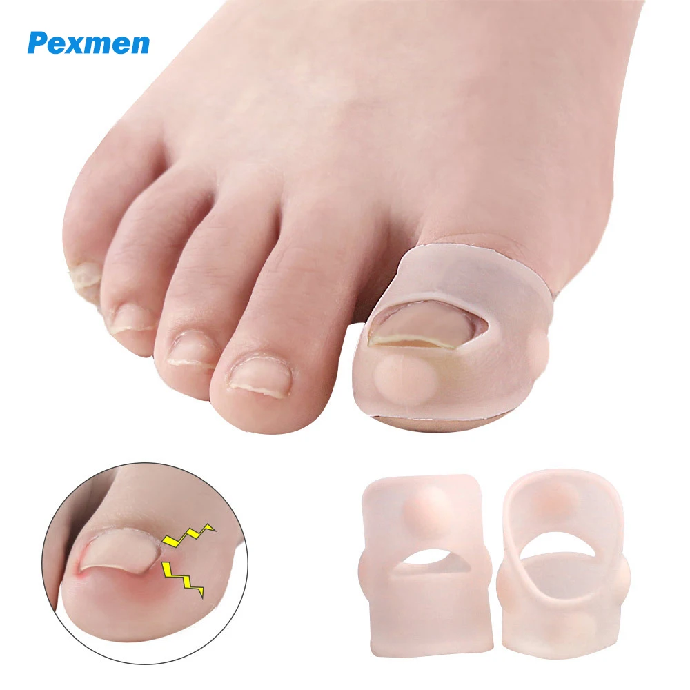 Pexmen 2/4/10Pcs Gel Ingrown Toenail Corrector Sleeves Big Toe Nail Healing Care Protector Paronychia Treatment Pedicure Tool sharkbang full set 3 holes binder photo album agenda notebook dairy kawaii bear rabbit notepad 10pcs sleeves school stationery