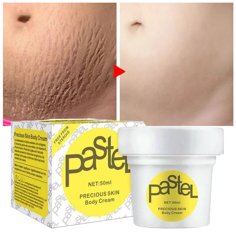 Skin Body Cream Remove Stretch Marks Treatment Postpartum Repair