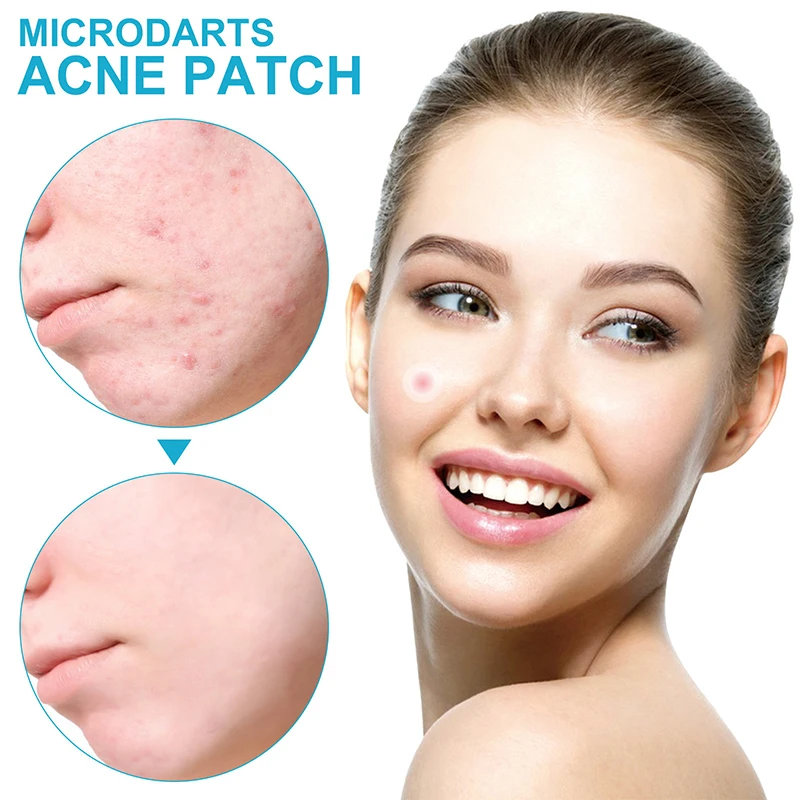 Face Patches For Pimples Microneedles Drying Patch Blemish Covering Stickers 6 Count Invisible Spot Care Absorbing All Day