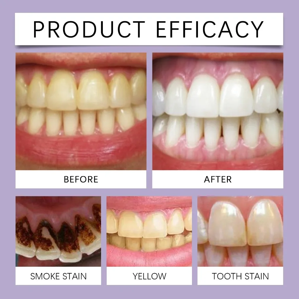 Anti Cavity Toothpaste Plaque Removal Enamel Repair Strengthen Teeth Brightening Oral Hygiene Cleaning Fresh Breath Toothpaste