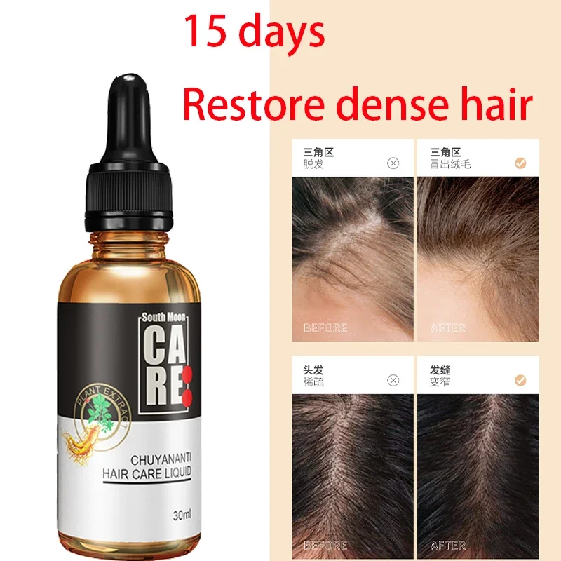 

Anti hair loss and development hair liquid, hair growth and enhancement hair care line, hair growth and hair growth liquid