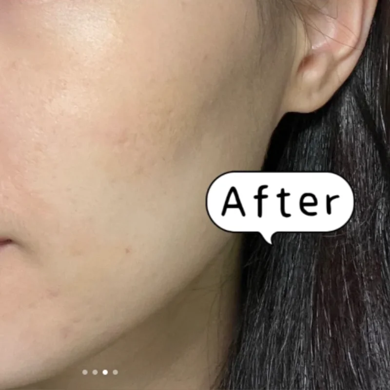 KATO Three-color Concealer Waterproof and Sweat-proof Concealer for Dark Circles and Acne Marks Long-lasting Concealer 5