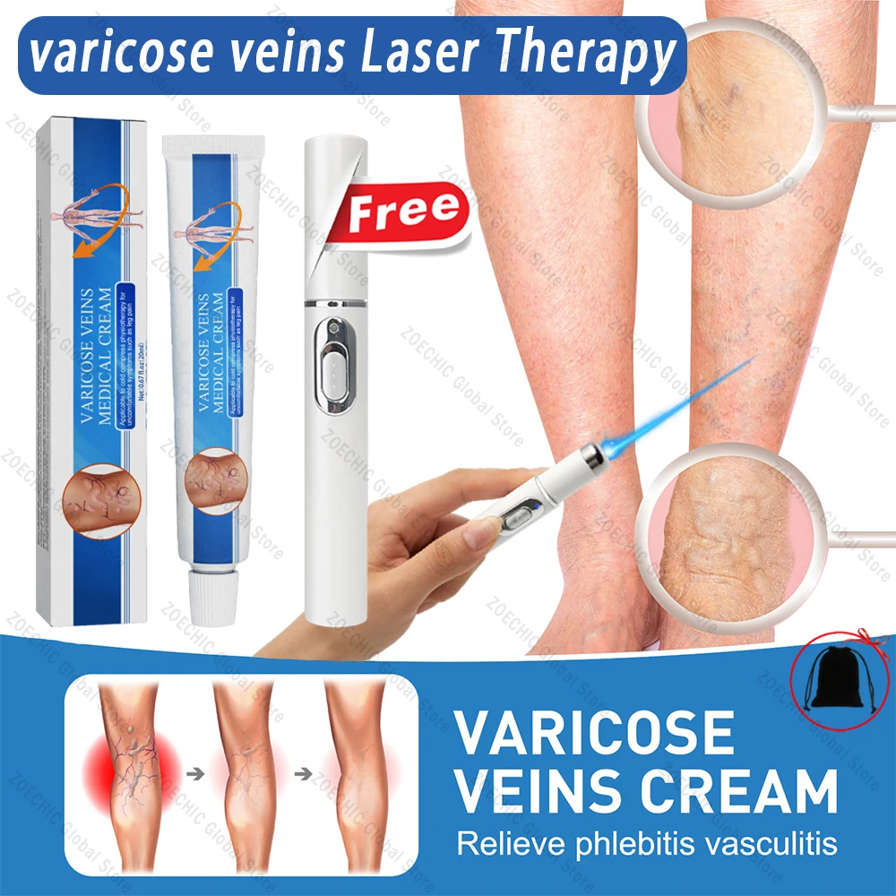 LaserTherapyVaricoseVeinsRelieveBlueLightPenEffectiveVaricose