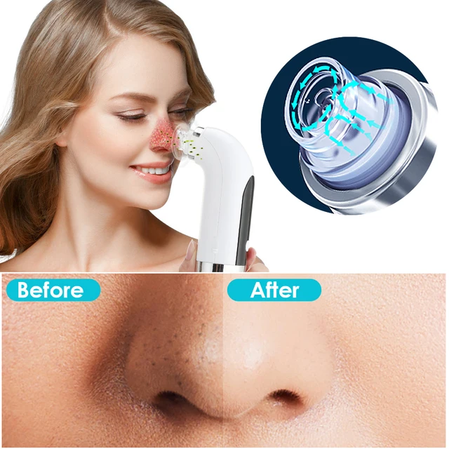 Electric Small Bubble Blackhead Remover USB Water Cycle Pore Acne Pimple Removal Vacuum Suction Facial Nose Cleaner Tool 4
