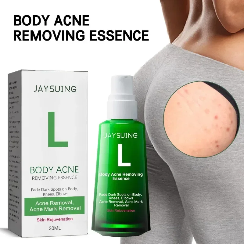Buttock Acne Removing Serum Body Whitening Essence Fade Acne Dar Spots Melanin Remove Acne Marks Moisturize Skin Care Lotion