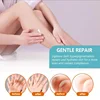 Skin Care Brighten Cream Bleaching Armpits Elbows Knees Moisturizing Body Lotion Cream Brightening Lightening Melanin Skin Cream 4