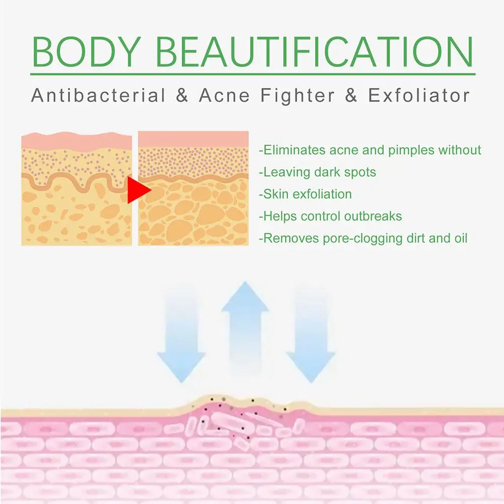 30ml Acne Remover Face Serum Herbs Acne Treatment Pimple Remover Shrink Pores Oil Control Face Herb Acne Skin Care_voghion.com