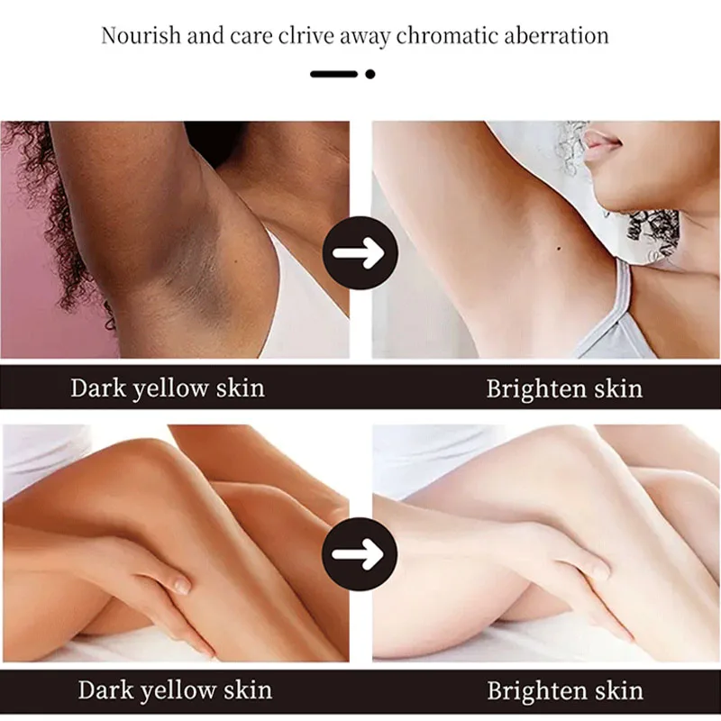 Body Whitening Cream Underarm Knee Buttocks Private Parts Bleach Inner Thighs Intimate Area Remove Melanin Brighten Skin Care 2