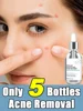Salicylic Acid  Solution Essence Shrink pores and Acne Spot Removing Shrink Pores Oil-Control Brighten Face Skin Makeup 1