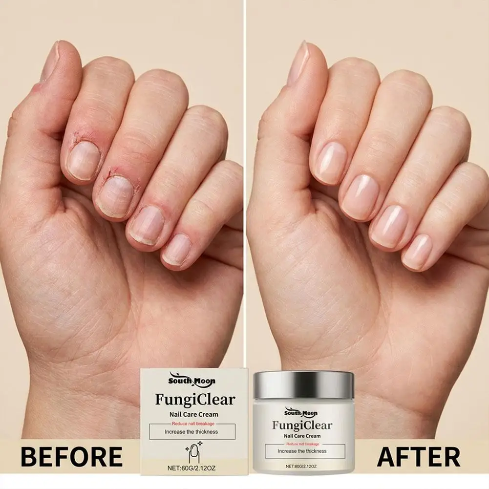 Nourishing Nail & Cuticle Care Cream - Daily Moisturizing & Repair Treatment