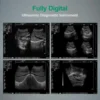 Ultrasound Scanner Veterinary for Pregnancy, Vet Portable B-Ultra Sound Scanner Machine Farm Animals Pet, Dog Cat Pregnancy Test 3