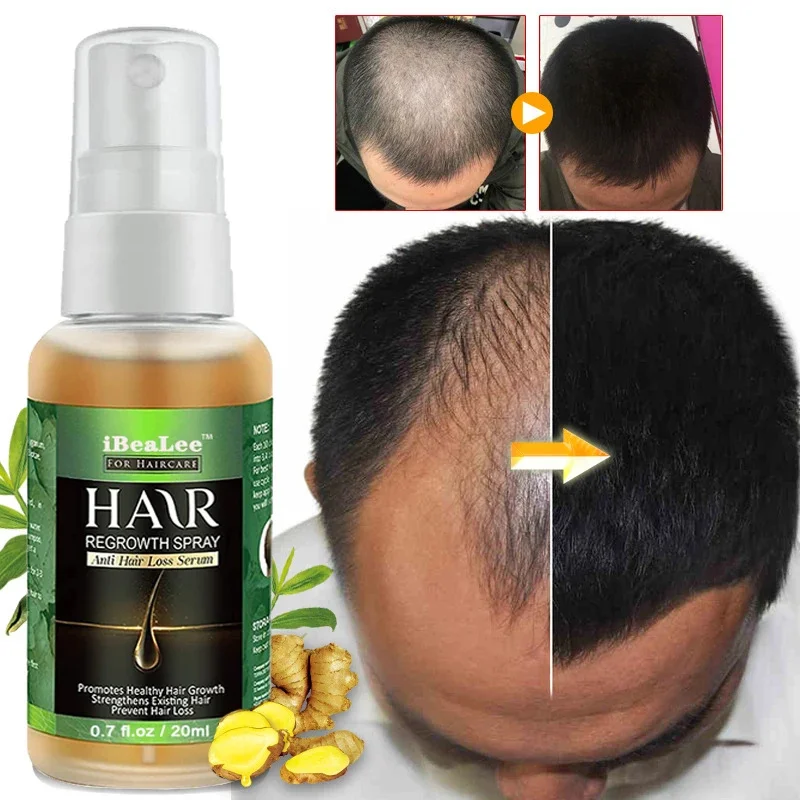 

Ginger Extract Fast Hair Growth Serum Spray Prevent Hair Loss Anti-Baldness Damage Repair Hair Root Strengthen Health Hair Care