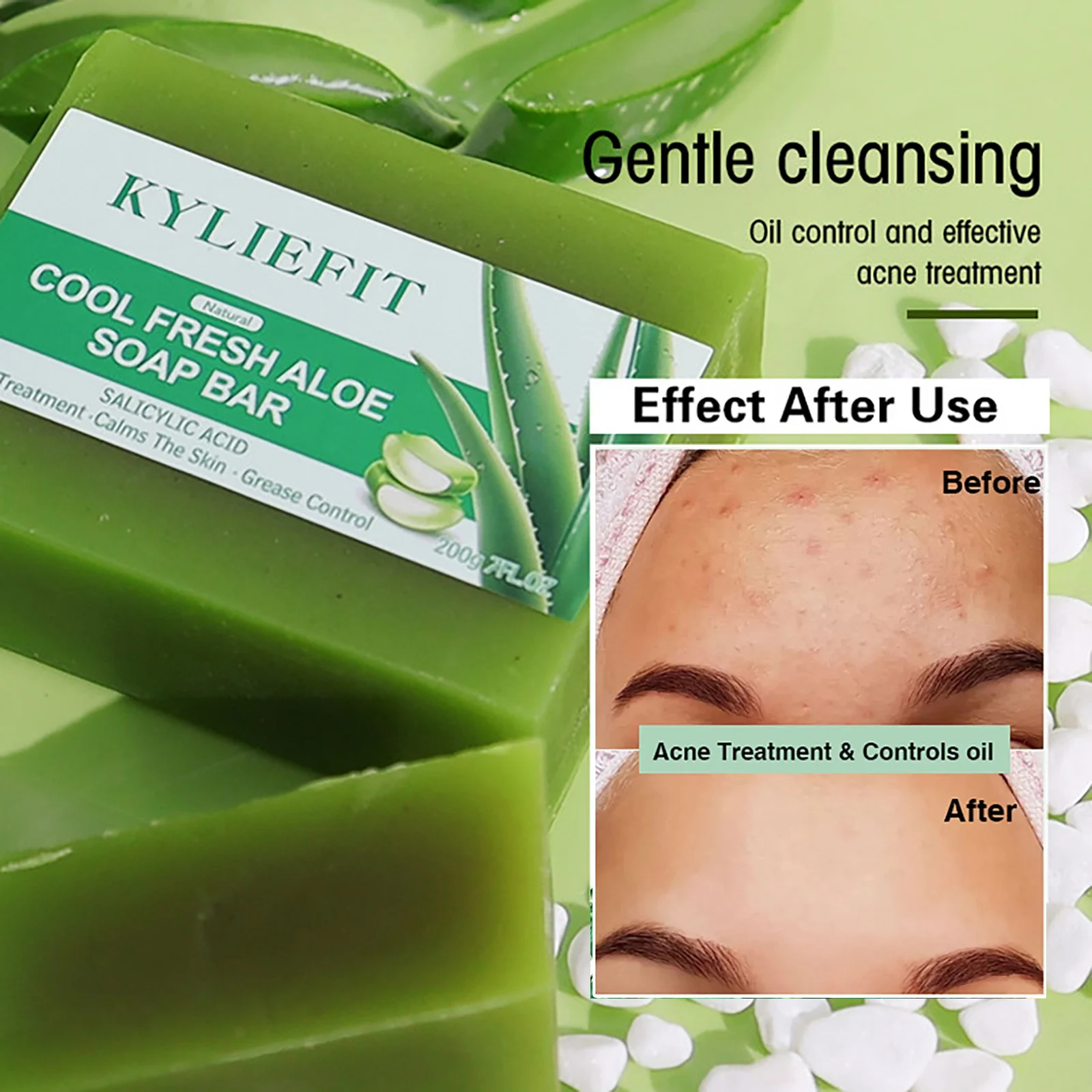 AILKE Aloe Vera Whitening Soap, Remove Acne, Pimples, Skin Radiant, Improve Skin Luster, Vegan Bath Wash for All Skin Types 6