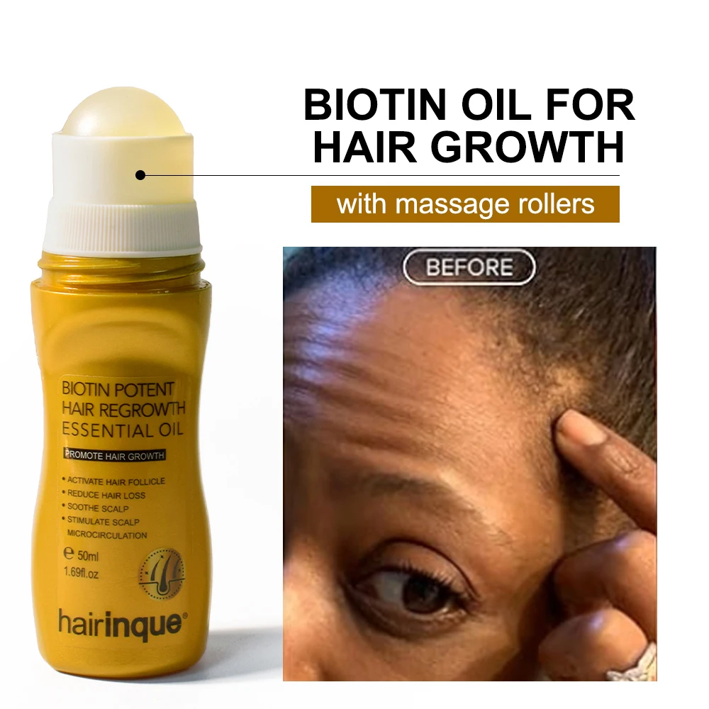 Hair Growth Serum Men Women Biotin Potent Hair Growth Essence Powerful Hair Thickener Massage Oil Scalp Treatments Anti Loss Medicine Care