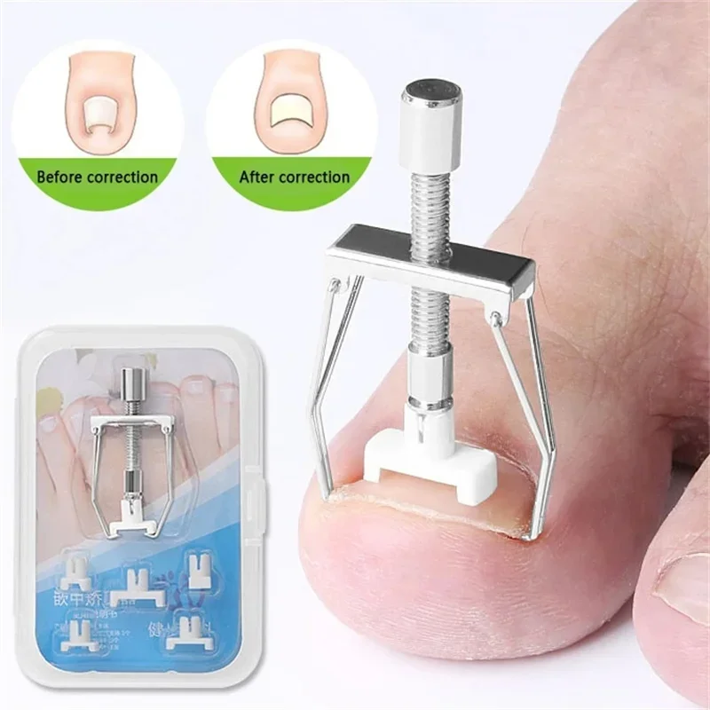 Ingrown Toe Nail Recover Correction Tool Pedicure Toenail Fixer Foot Nail Care Tool Orthotic Corrector Pedicure New ingrown toenail correction tool,manicure pedicure tool set,foot care tool,foot pedicure tool,toe corrector,nail problem solving,mens foot care product
