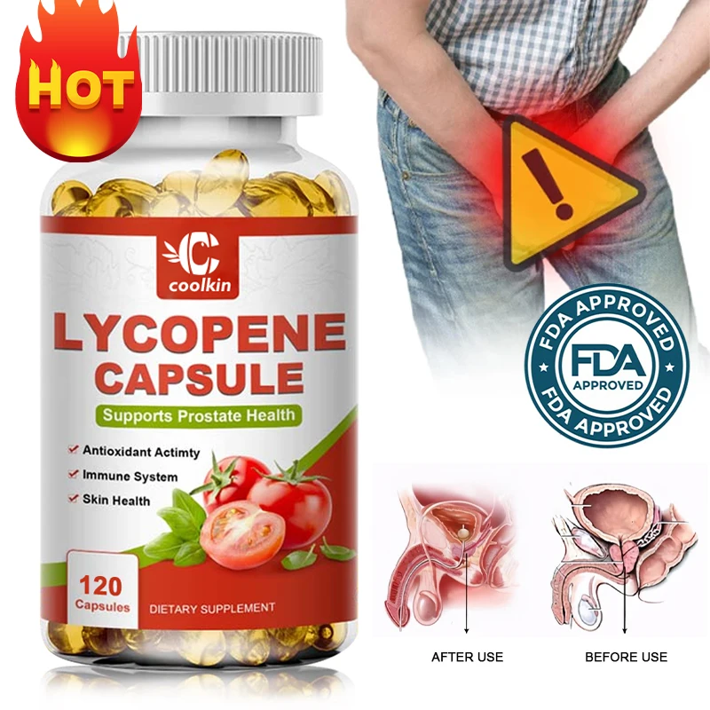 Prostate Health Support, Lycopene Supplement, Antioxidant, Dietary