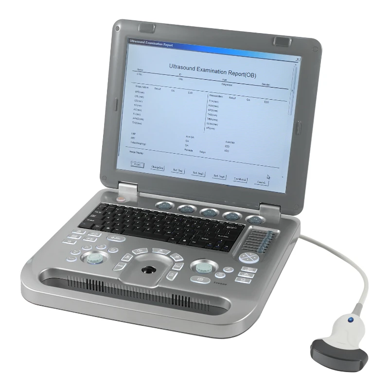 

Animal ultrasound diagnose portable vet digital canine ultrasound machine