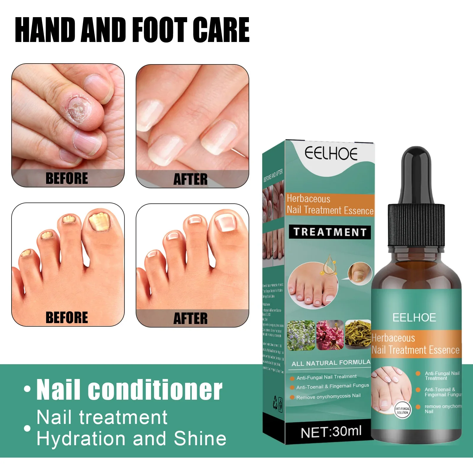 

Nail Repair Essence Nail Growth Polish Fingernail Repair Promotes Repair Function Provides Rich Nutrition Strengthen Nails uñas