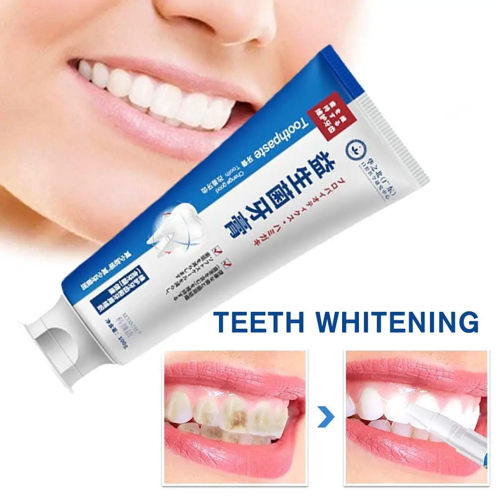 1/2pcs Quick Repair Of Cavities Caries Filling Removal Repair Stains Plaque Yellowing Teeth Whitening Whitening Teeth Toothpaste