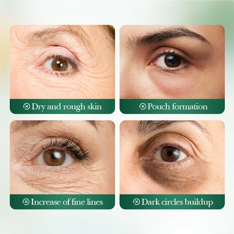 SADOER Sakura Crystal Collagen Eye Mask Anti Dark Circles Removal Eyes Bags anti-aging Moisturizing Anti Wrinkles Eye Patches