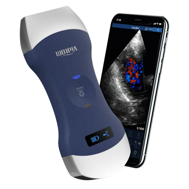 超音波画像診断装置 ポータブルエコー sonosite nanomaxx - 福岡県の家具 