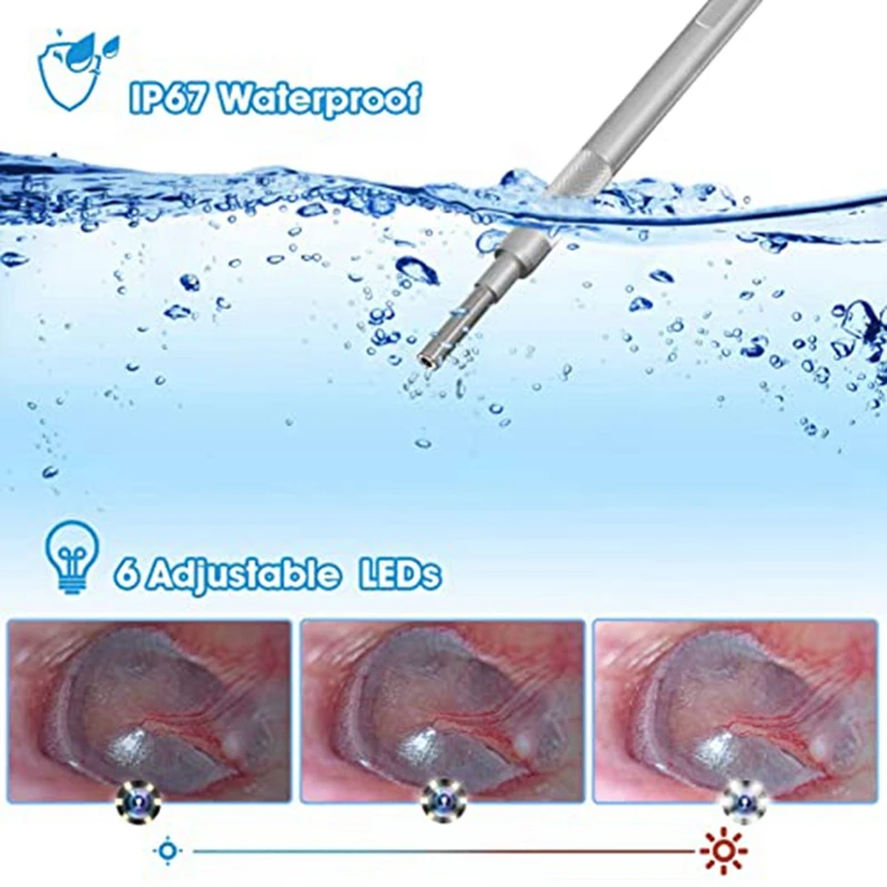 Digital Otoscope Set With 7-Inch Screen Ear Camera Kit Visual Ear Scoop Supports Photo Snapshots And Video Recording 6