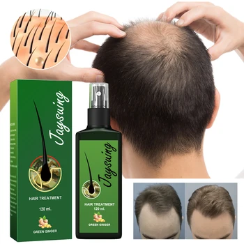 Spray per la Cura dei Capelli allo Zenzero, Siero per Massaggio del Cuoio Capelluto, Migliora la Secchezza e i Danni, Nutre e Ripara le Radici, Essenza Anti-Caduta per Uomini e Donne