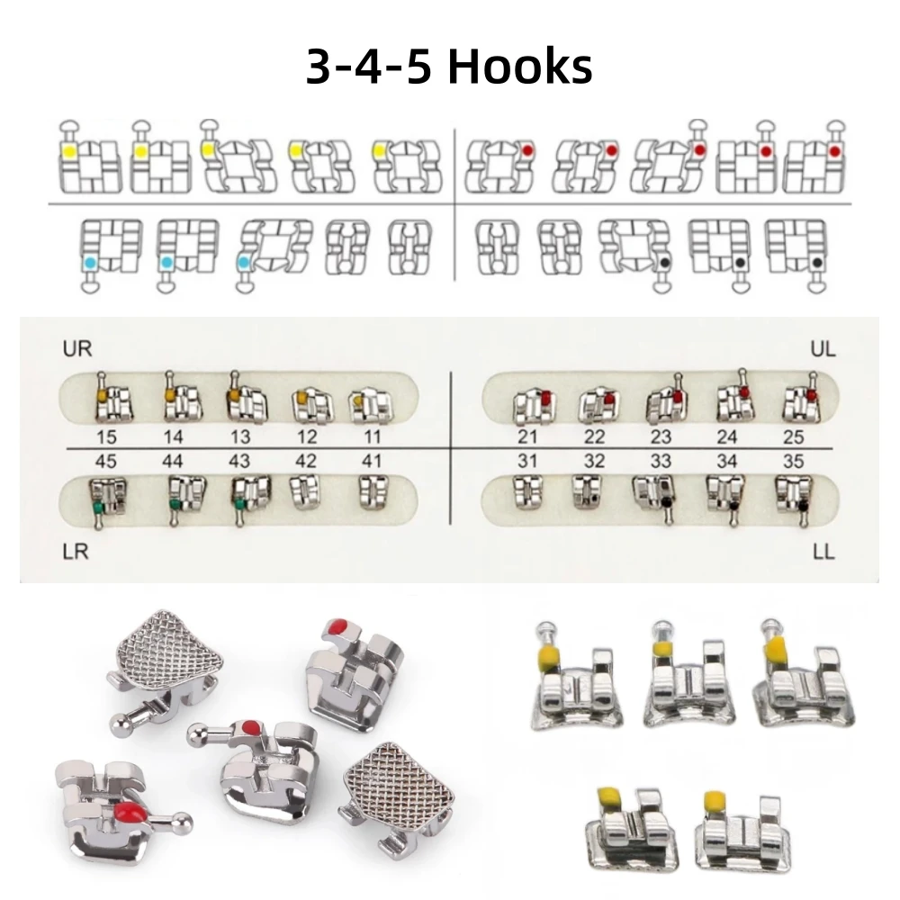 Рисунок 4 - Ортодонтические скобы для зубов