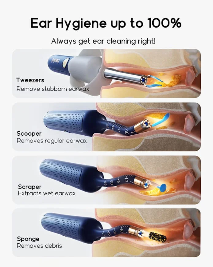 Bebird Visual Earwax Removal Kit With Hd Camera And Tweezers_voghion.com