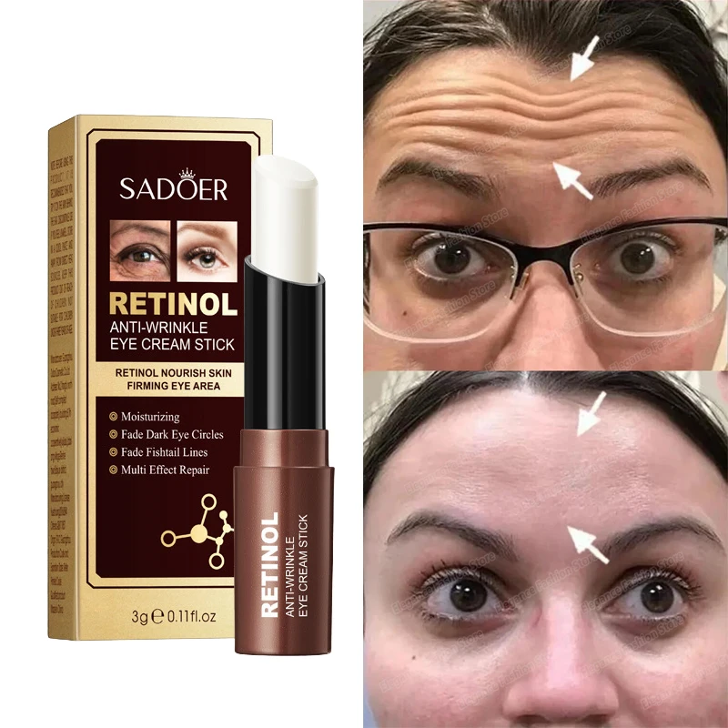Retinol Anti-Wrinkle Eye Cream Stick Under Eye Bags Puffiness Remove Dark Circles Reduce Fine Line Tighten Eyes Korean Cosmetics